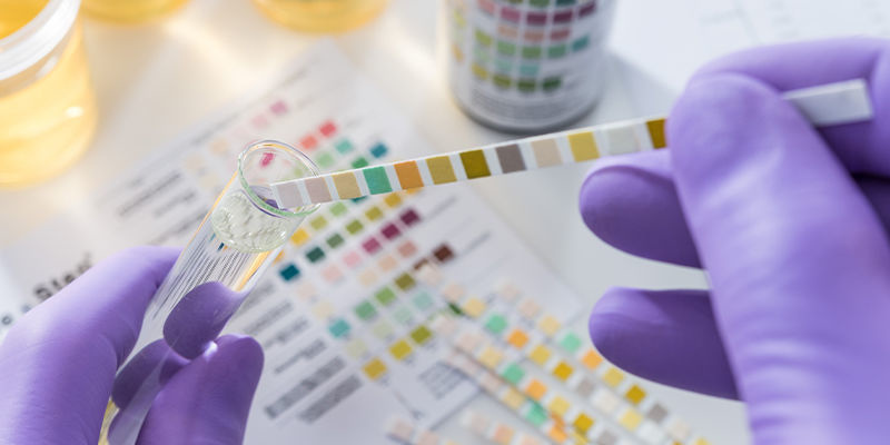 Kann der Konsum von Kratom durch einen Drogentest nachgewiesen werden?