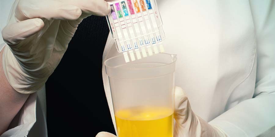 Während Eines Drogentests Während eines Drogentests