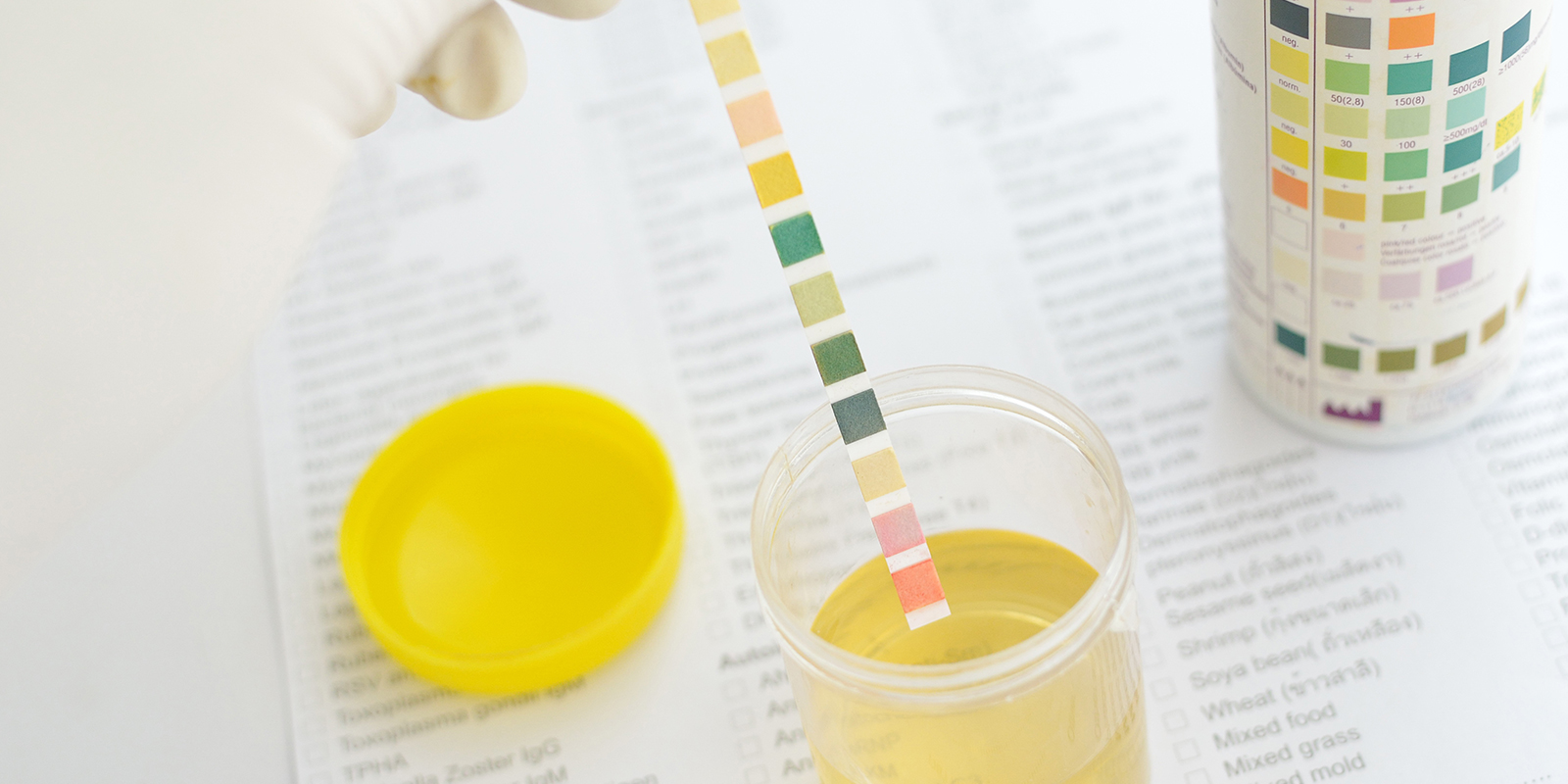 Halbwahrheiten: Detox-Drinks, Austausch & synthetischer Urin