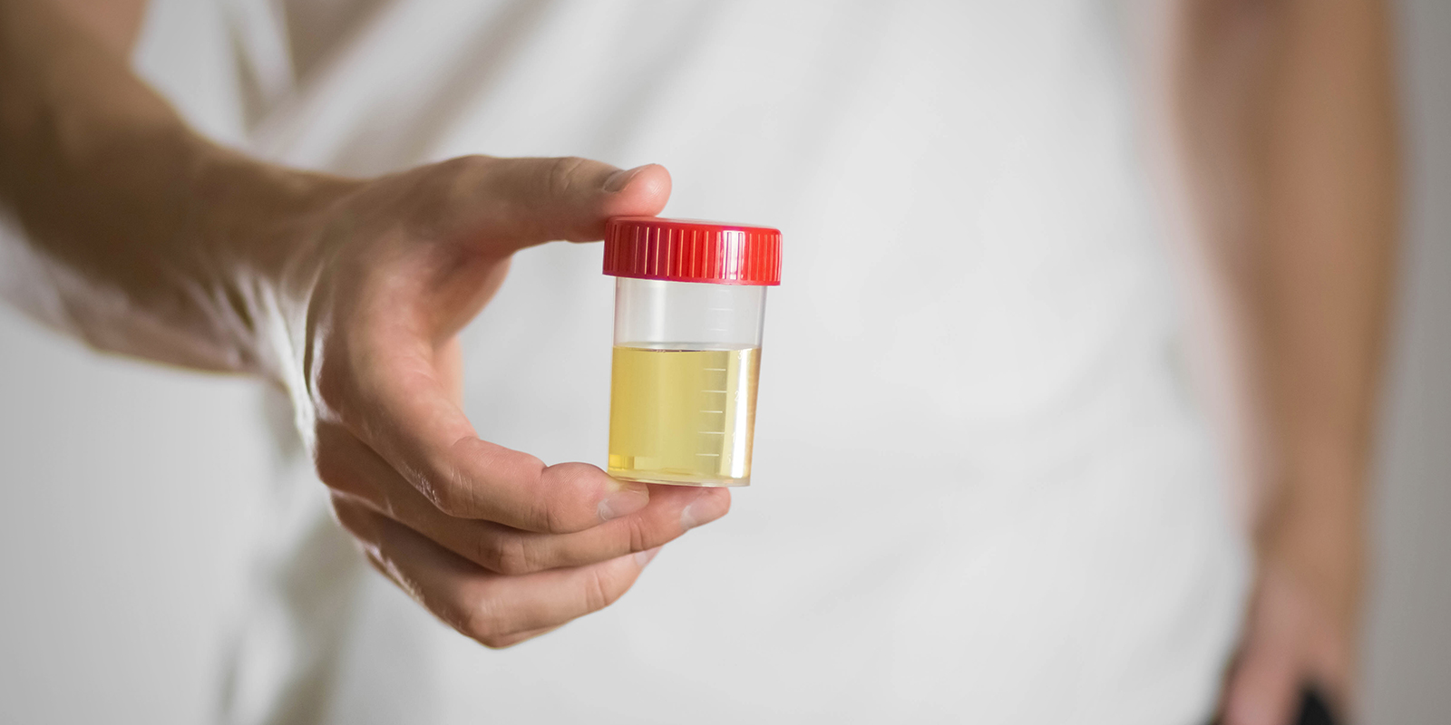 Mythos 8: Urinprobe austauschen