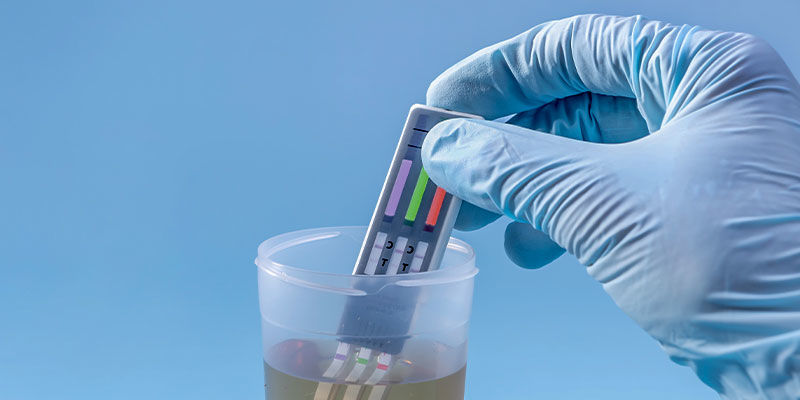 Faktoren, Die Den Nachweis Beeinflussen Faktoren, die den Nachweis beeinflussen