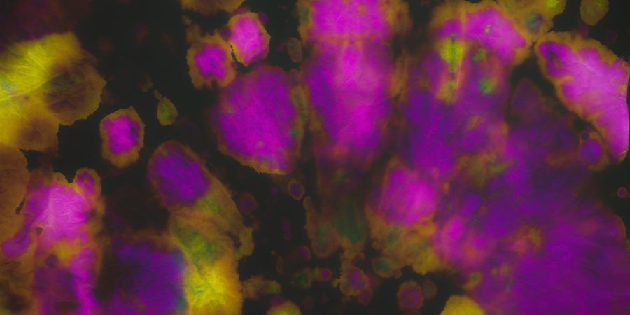 Closed-Eye Visuals (CEVs; Halluzinationen Mit Geschlossenen Augen) Closed-eye Visuals (CEVs; Halluzinationen mit geschlossenen Augen)