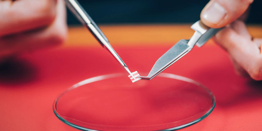 Dosierung Von LSD Dosierung von LSD