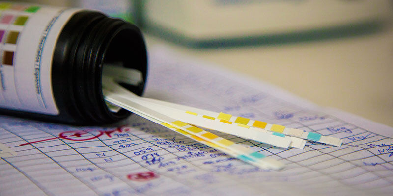 Speichel- Und Urin-Drogentests Speichel- und Urin-Drogentests