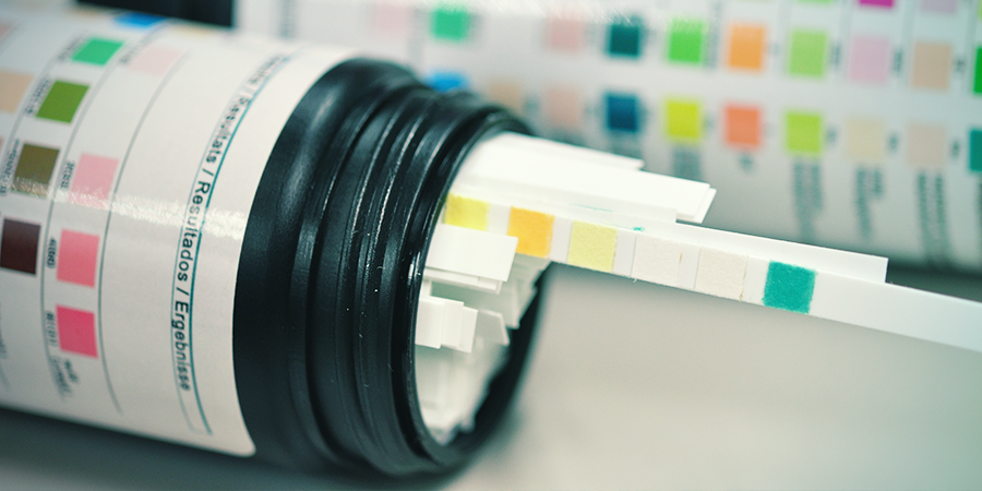 Wechselwirkung Zwischen CBD-kapseln, Drogentests Und Medikamenten Wechselwirkung Zwischen CBD-kapseln, Drogentests Und Medikamenten