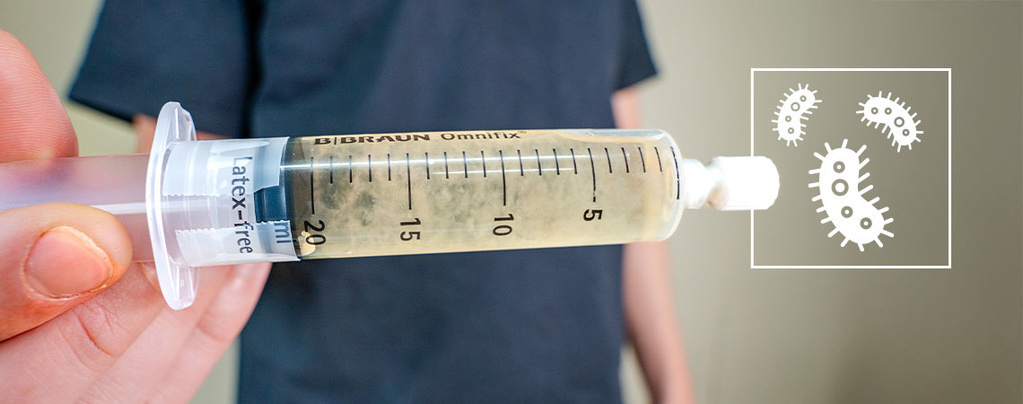 Was ist eine Flüssigkultur? Der komplette Guide für Einsteiger