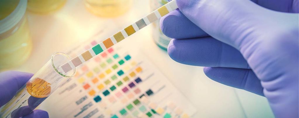 Drogentests: Alles Wissenswerte