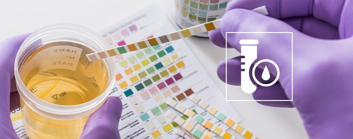 Wie Man Einen THC-Drogentest Besteht (2025)