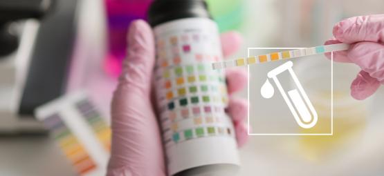 Wird Kratom bei einem Drogentest angezeigt?