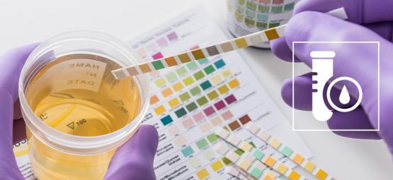 Wie Man Einen THC-Drogentest Besteht (2025)